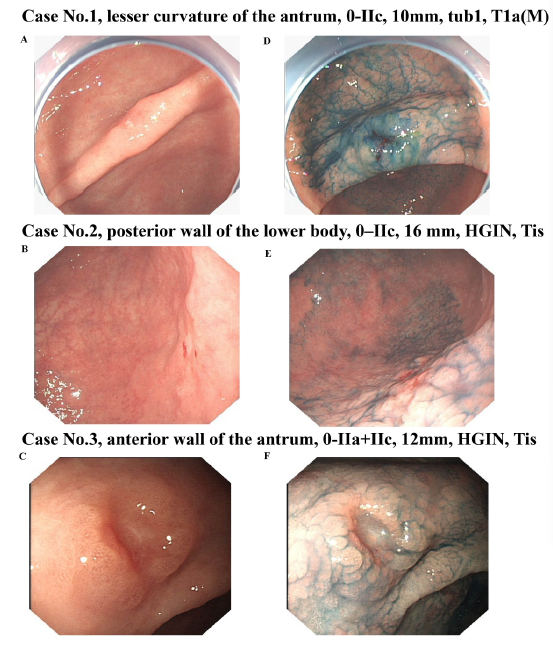 亚游集团·ag8(中国)官网-只為非同凡享